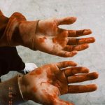 中条あやみ、「君と世界が終わる日に」撮影中の血塗れショット公開「season2楽しんで頂けてますか？？」