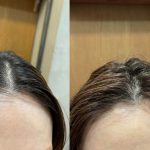 BEAUTRIUM 久住桃子に聞く韓国発祥の話題のヘアスタイル「プリカール」