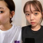 江野沢愛美がニキビに悩んだ過去を初告白、肌荒れ写真公開にも反響
