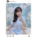 楠偉音、太ももチラ見せのナースコスに入院希望者続出！